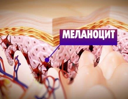 Из этих клеток может, при определенных условиях, вырасти меланома