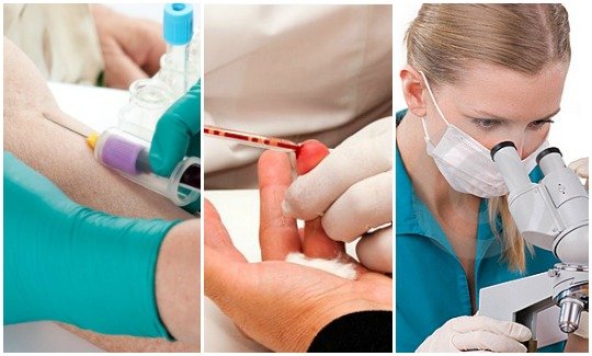 Диагностика ихтиоза Методы диагностики при ихтиозе