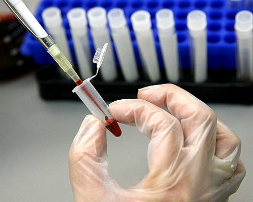 причины дефицита железа причины дефицита железа