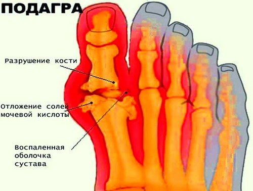 Клиническая картина заболевания
