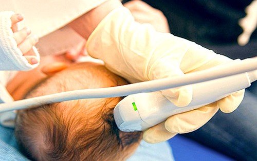 УЗИ головы новорожденного рекомендуется проводить постоянно УЗИ головы новорожденного рекомендуется проводить постоянно