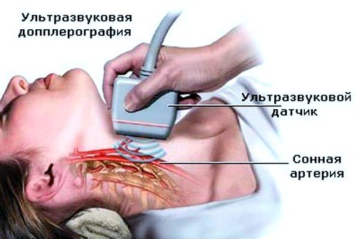 ангиография сосудов шеи рекомендуется при различных стадиях остеохондроза