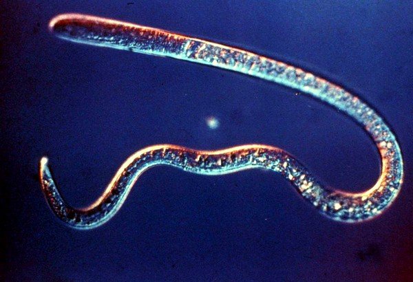 Trichinellosis (от латинского) — острый вид гельминтоза, появление которого провоцируют спиральные трихинеллы