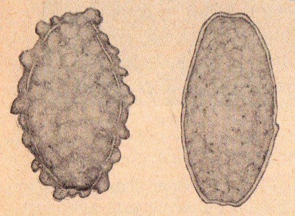 Яйца аскариды Яйца аскариды – это неразличимые невооруженным взглядом образования