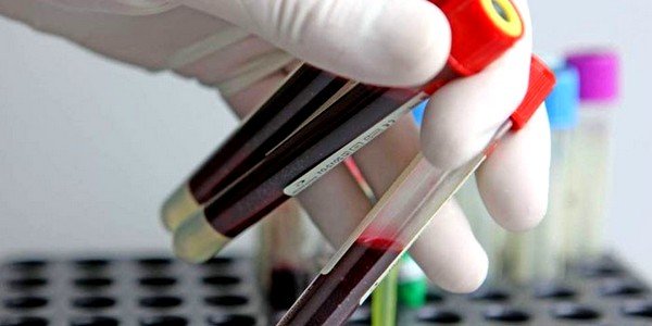 Для выявления паразитов в организме человека проводятся серологические исследования